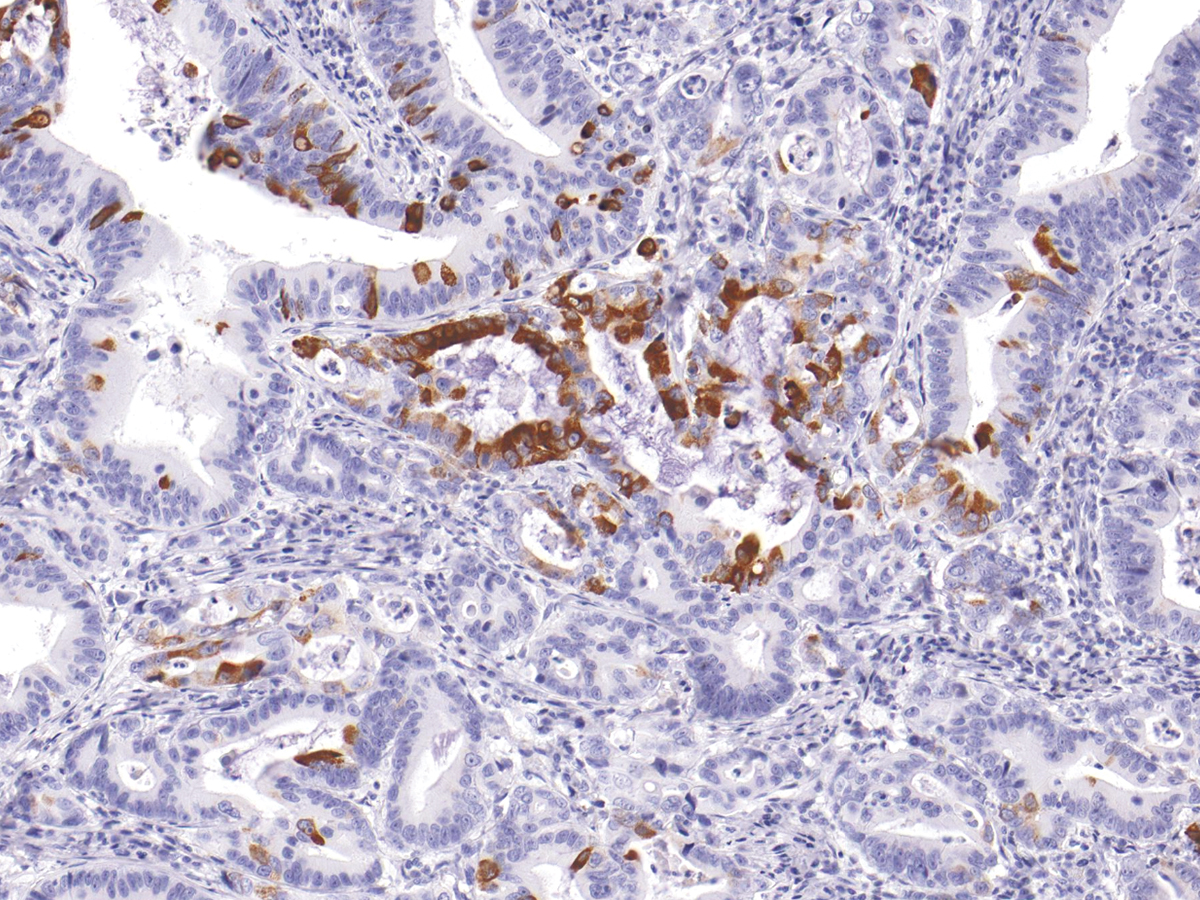 Anti-MUC5AC Monoclonal Antibody (Clone:IHC625)