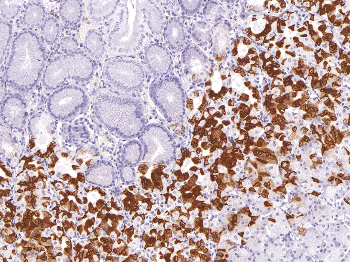 Anti-MUC6 Monoclonal Antibody (Clone:IHC626)-Ready to Use(Discontinued)