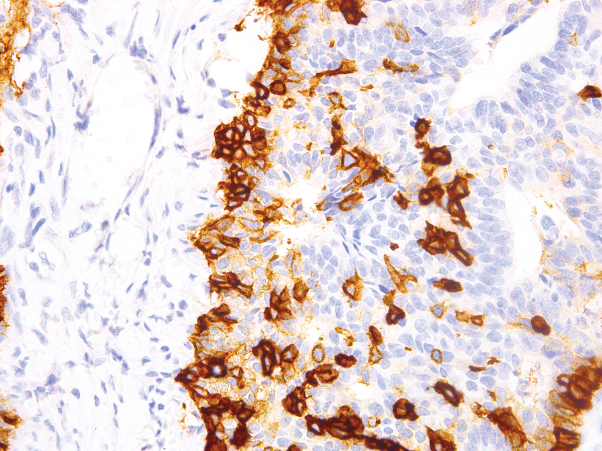 Anti-Nerve Growth Factor Receptor (NGFR) Monoclonal Antibody (Clone:IHC637)-Ready to Use