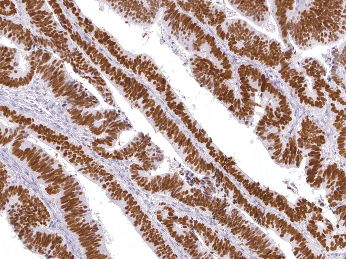 Anti-p53 Monoclonal Antibody (Clone:IHC053)