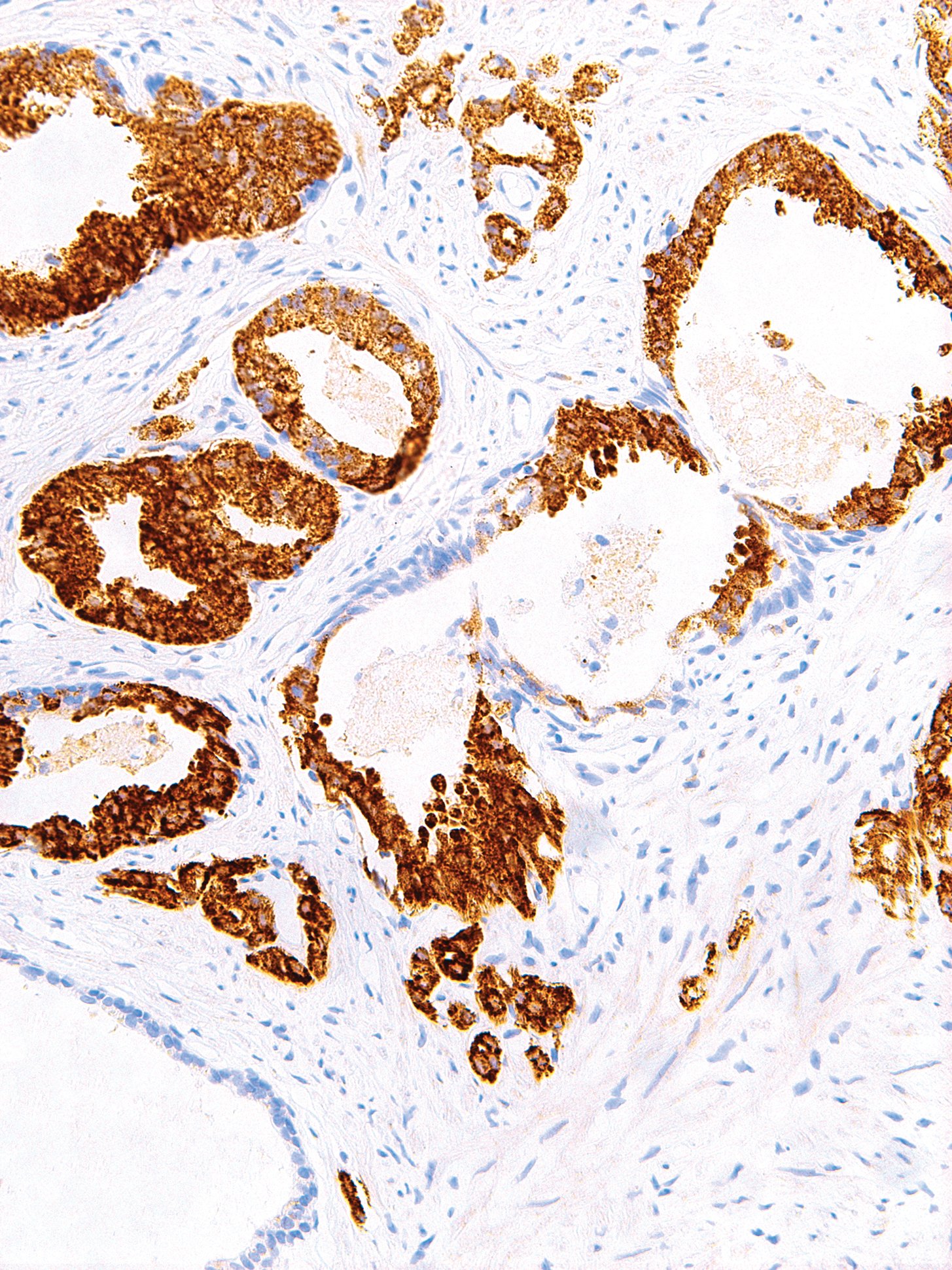 Anti-p504s Monoclonal Antibody (Clone:IHC524)(Discontinued)