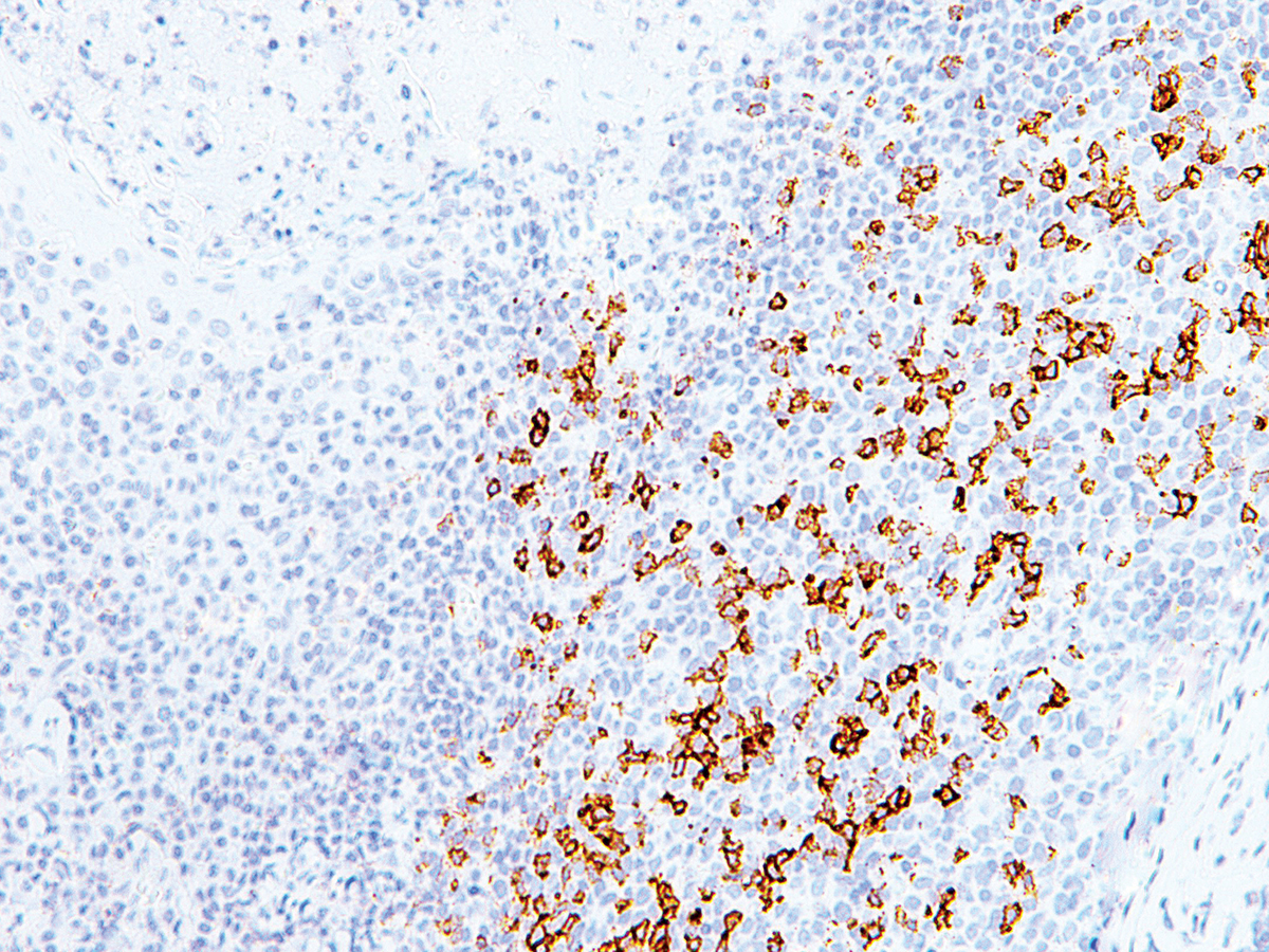 Anti-PD-1 Monoclonal Antibody (Clone:IHC001)-Ready to Use