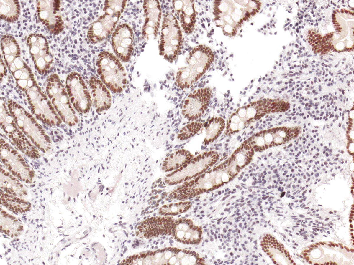 Anti-PMS2 Monoclonal Antibody (Clone:IHC412)(Discontinued)