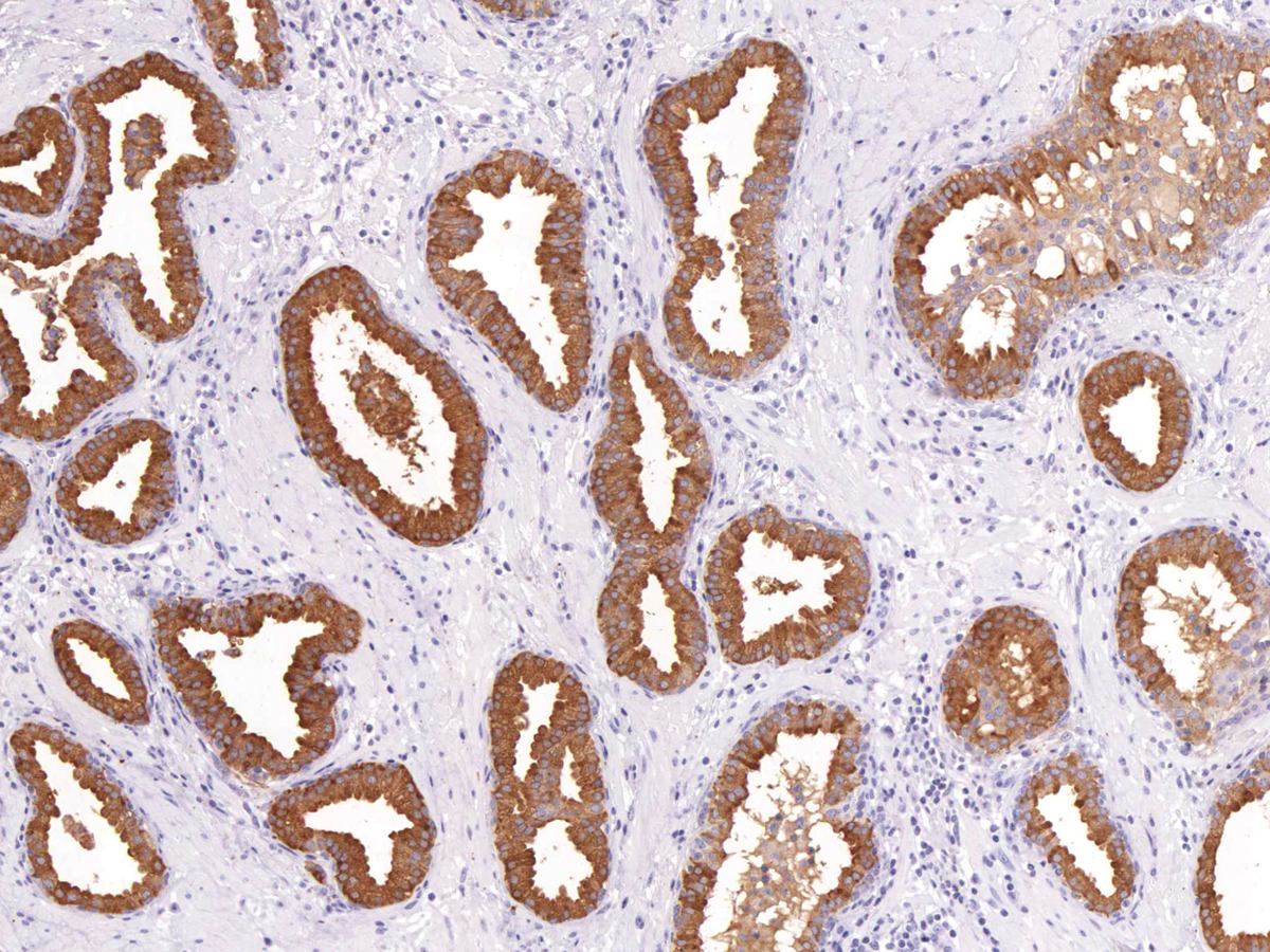 Anti-PSA Monoclonal Antibody (Clone:IHC654)