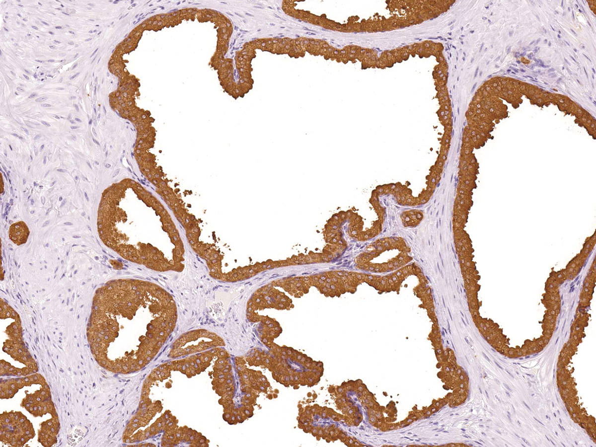 Anti-PSAP Monoclonal Antibody (Clone:IHC655)-Ready to Use