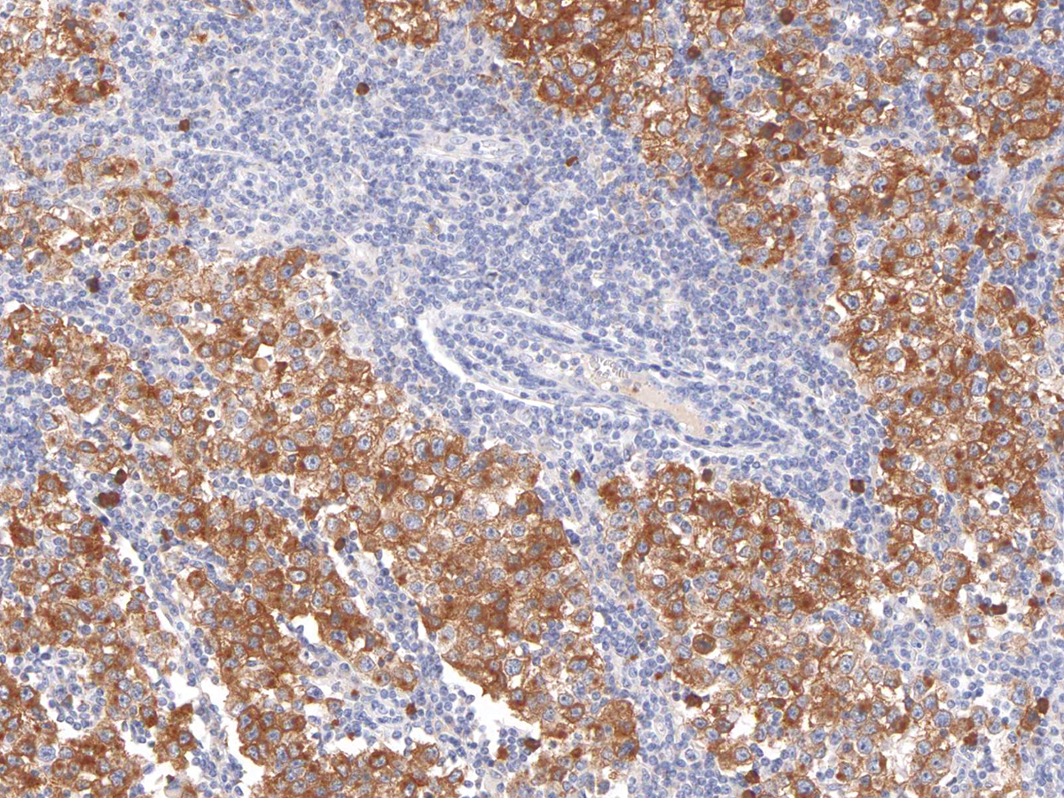 Anti-Podoplanin Monoclonal Antibody (Clone:IHC650)