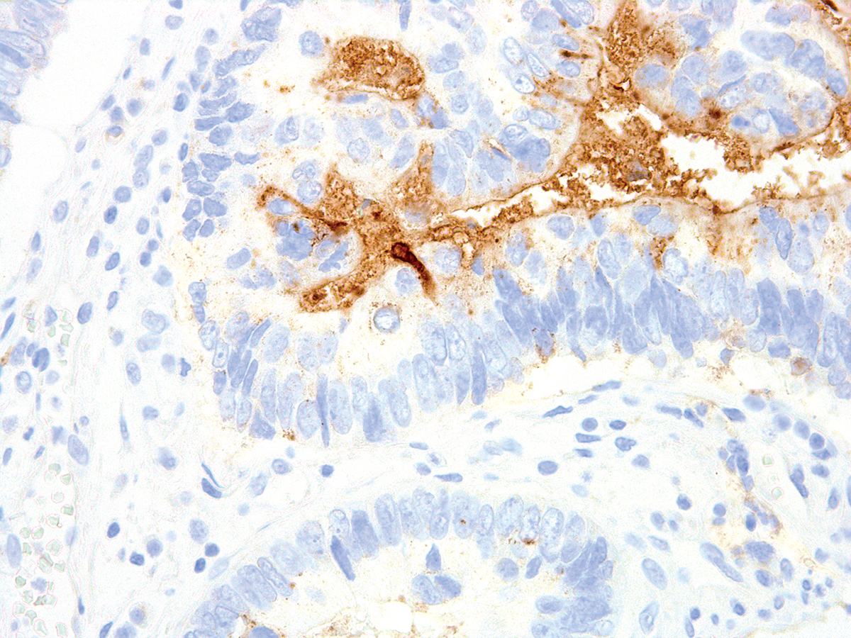 Anti-TAG-72 Monoclonal Antibody (Clone:IHC072)-Ready to Use