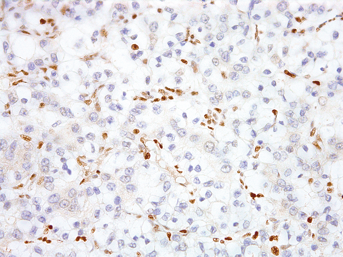 Anti-TFE3 Monoclonal Antibody (Clone:IHC672)