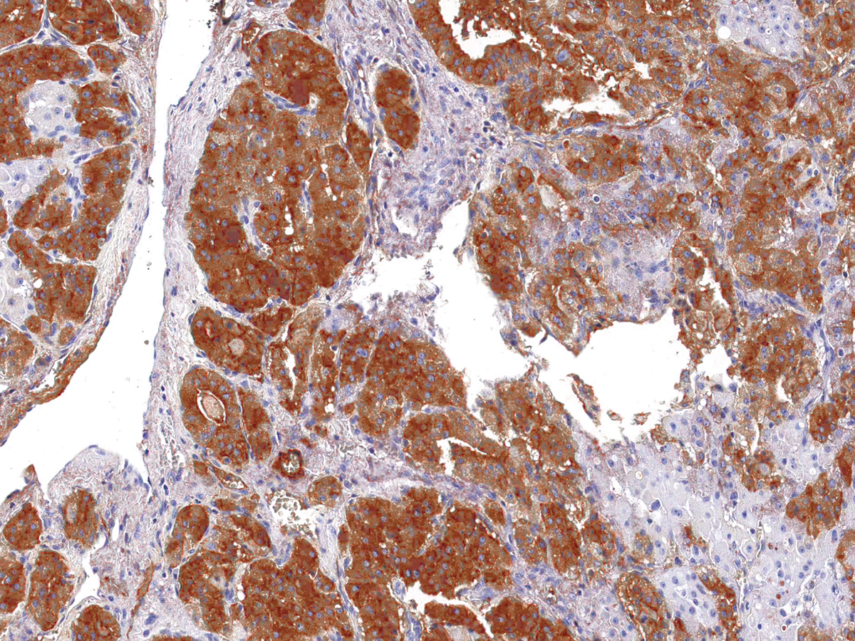 Anti-Thyroglobulin  Monoclonal Antibody (Clone:IHC674)