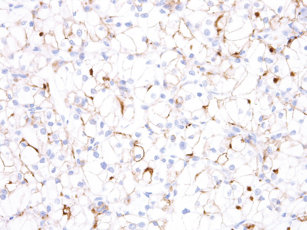 Anti-TIM3 Monoclonal Antibody (Clone:IHC003)