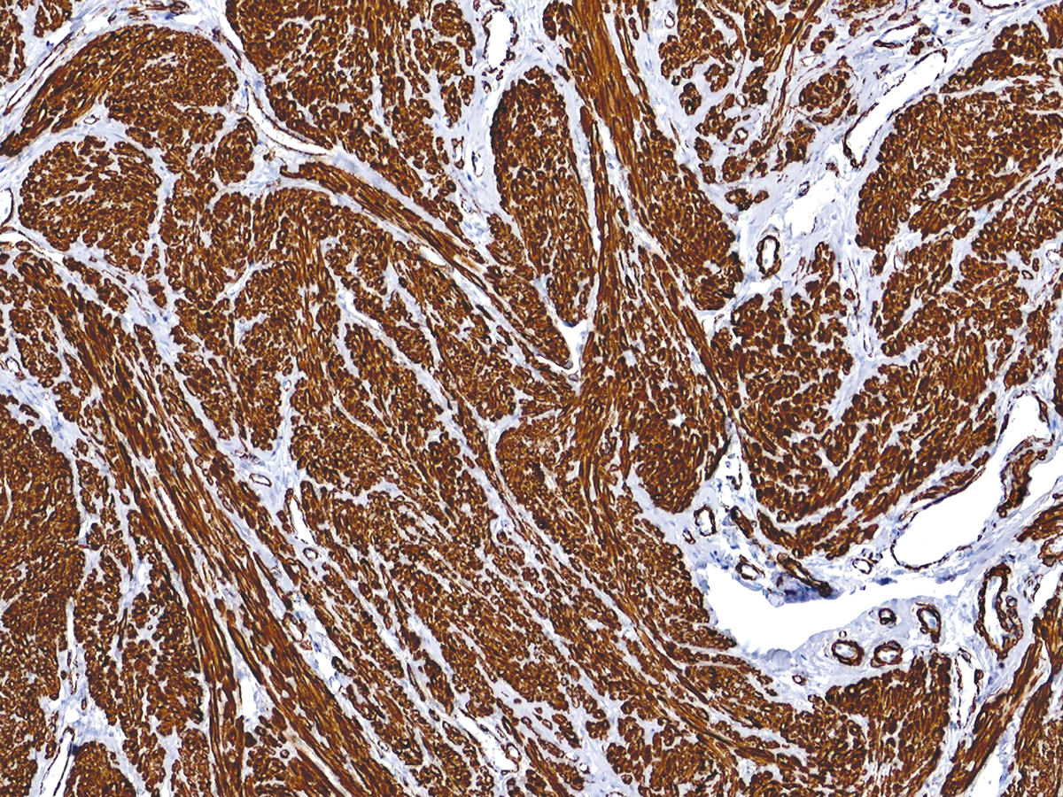 Anti-Actin, Smooth Muscle Monoclonal Antibody (Clone:IHC506)