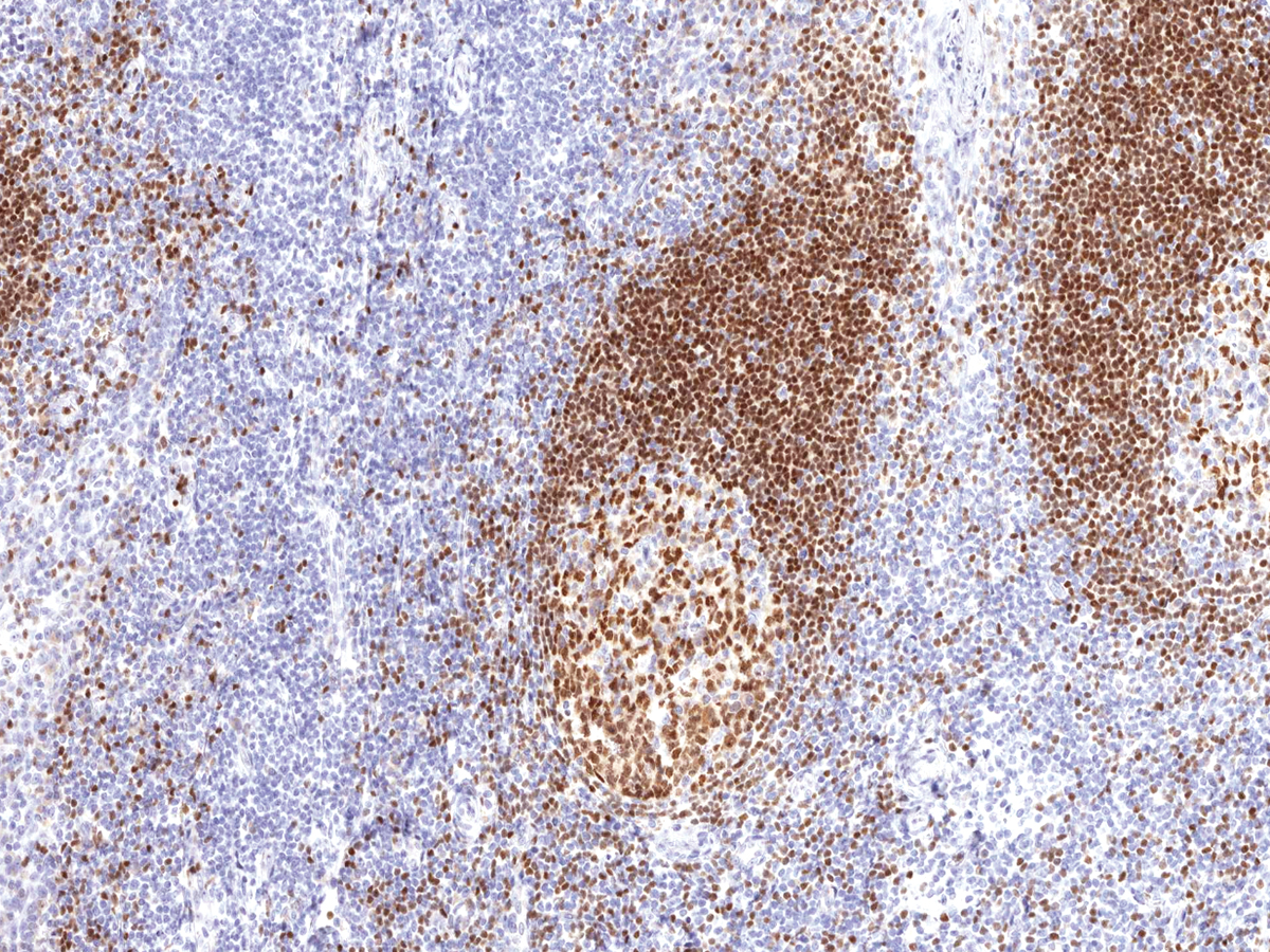 Anti-PAX-5 Monoclonal Antibody (Clone:IHC005)-Ready to Use(Discontinued)