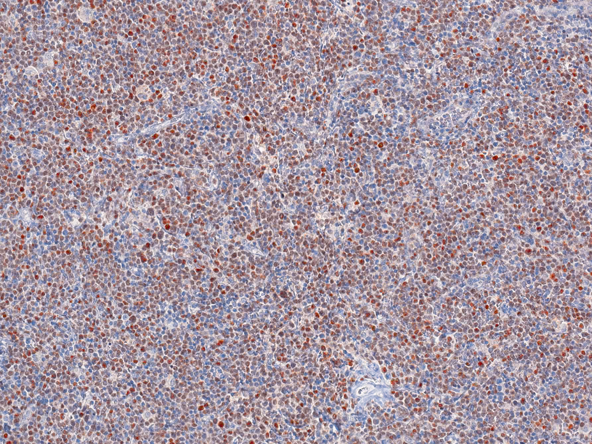 Anti-SOX-11 Monoclonal Antibody (Clone:IHC011)(Discontinued)