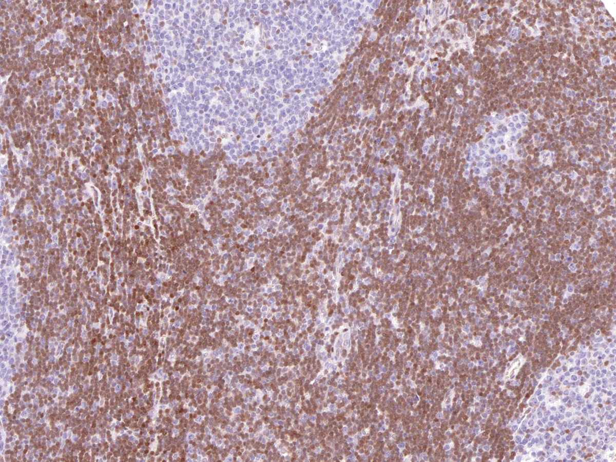 Anti-p27 Monoclonal Antibody (Clone:IHC027)-Ready to Use(Discontinued)