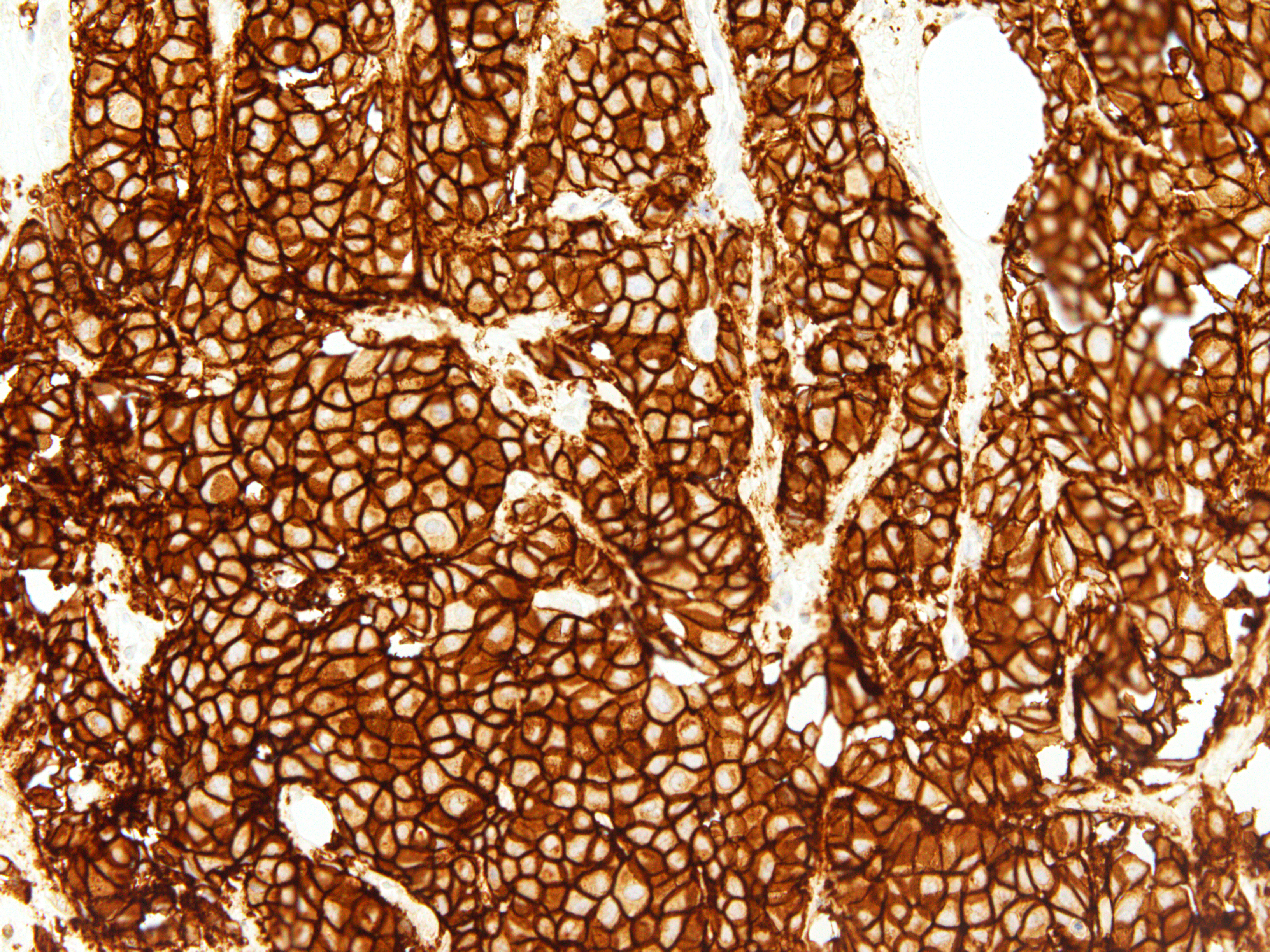 Anti-Her2/Neu Monoclonal Antibody (Clone:IHC042)