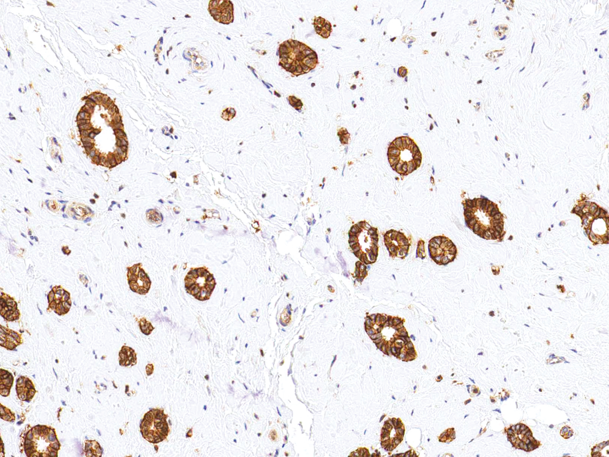 Anti-CD44 Monoclonal Antibody (Clone:IHC044)-Ready to Use(Discontinued)