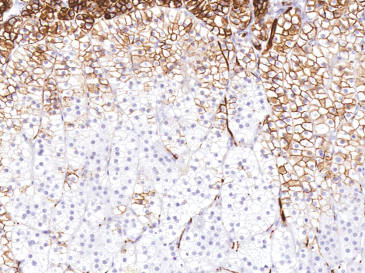 Anti-CD56 Monoclonal Antibody (Clone:IHC056)-Ready to Use(Discontinued)