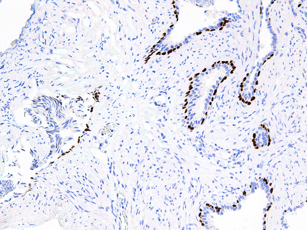 Anti-p63 Monoclonal Antibody (Clone:IHC063)-Ready to Use