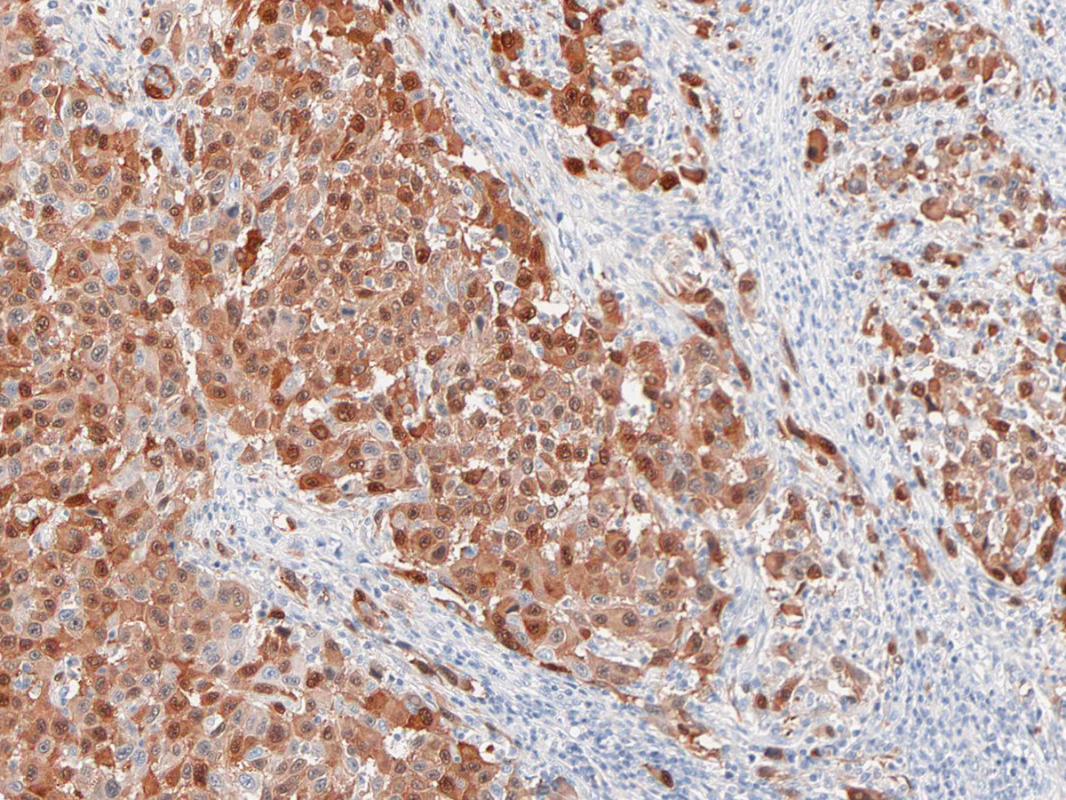 Anti-s-100 Monoclonal Antibody (Clone:IHC100)