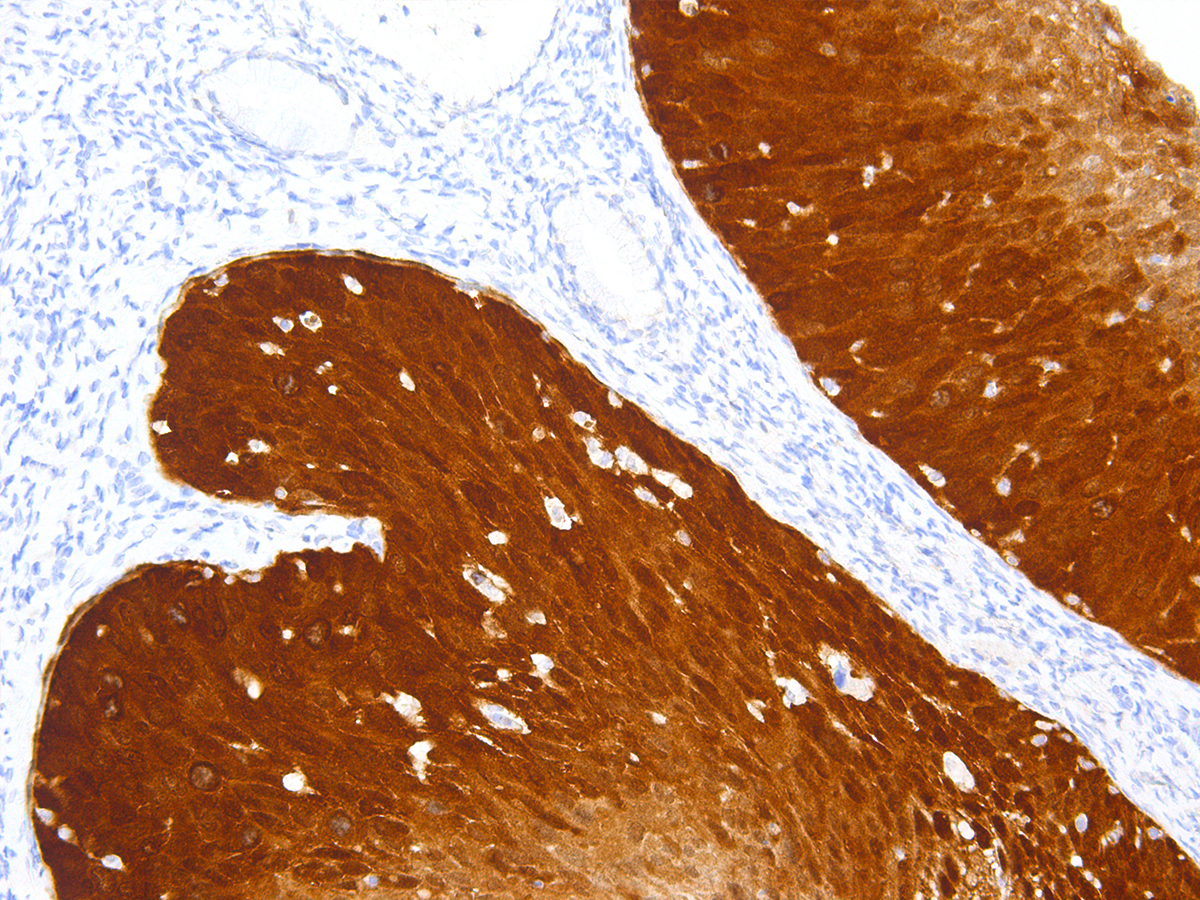 Anti-p16 Monoclonal Antibody (Clone:IHC116)