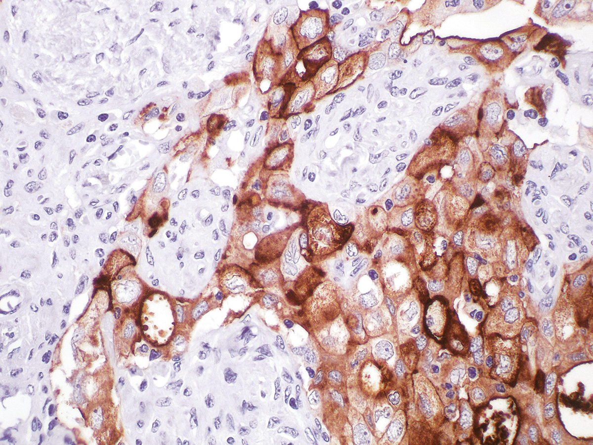 Anti-CA-125 Monoclonal Antibody (Clone:IHC125)