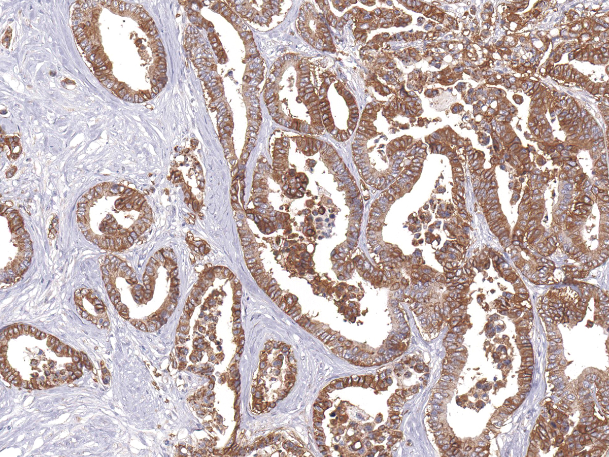 Anti-GLUT1 Monoclonal Antibody (Clone:IHC404)