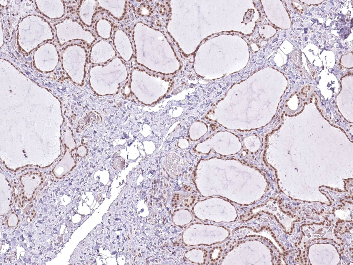 Anti-TTF-1 Monoclonal Antibody (Clone:IHC414)(Discontinued)