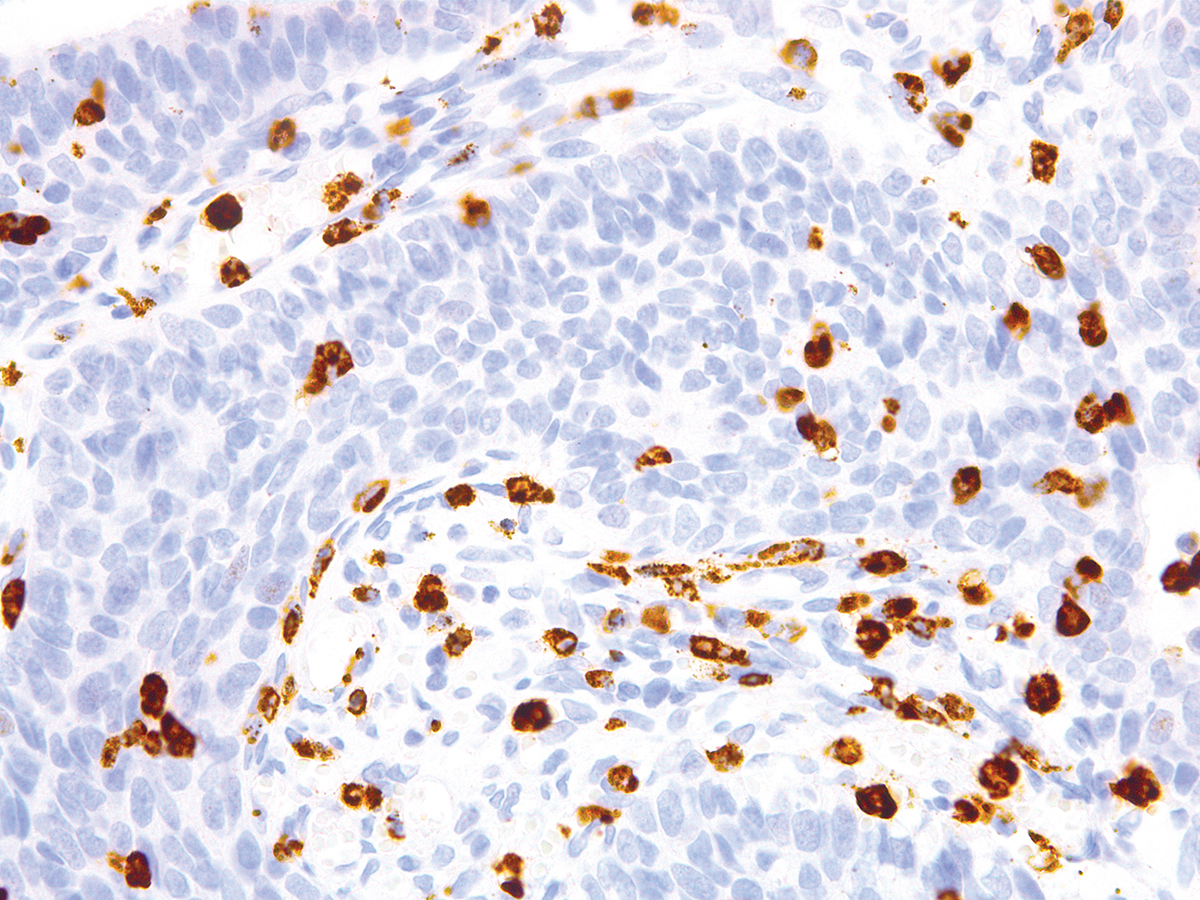 Anti-CD15/Leu-M1 Monoclonal Antibody (Clone:IHC527)-Ready to Use