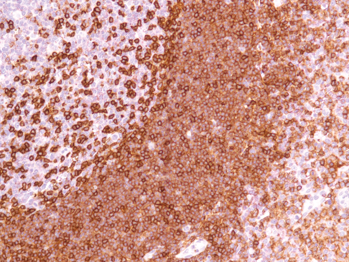 Anti-CD45R Monoclonal Antibody (Clone:IHC536)