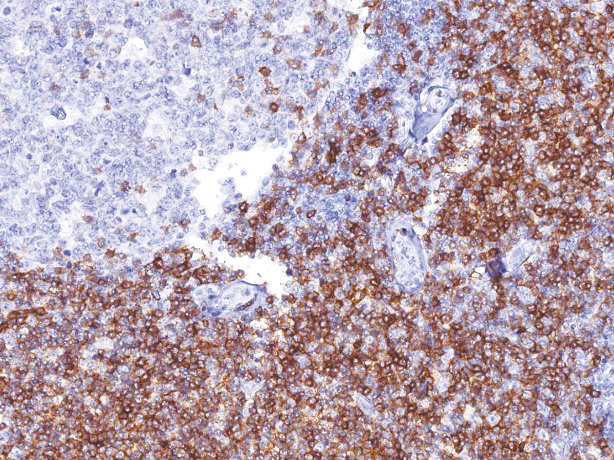 Anti-CD5 Monoclonal Antibody (Clone:IHC538)-Ready to Use(Discontinued)