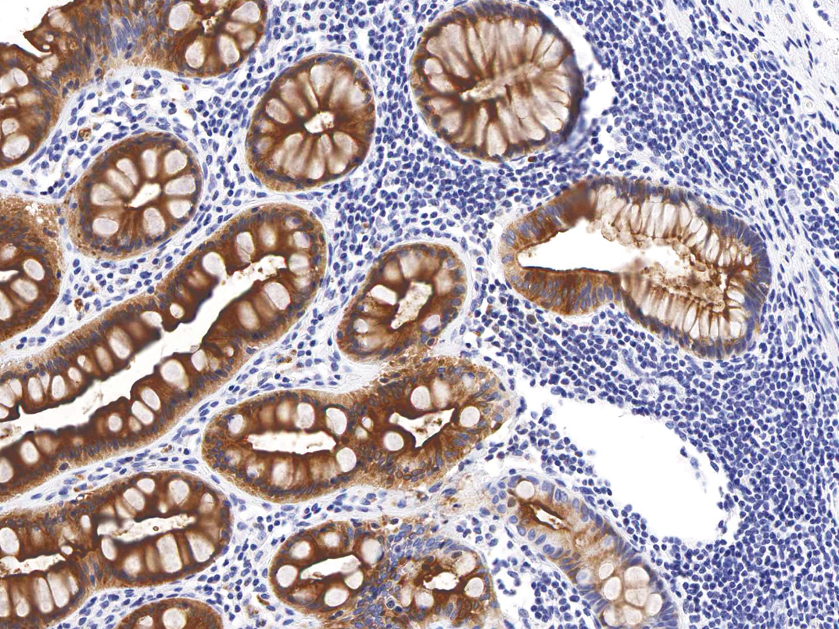 Anti-CEA  Monoclonal Antibody (Clone:IHC543)-Ready to Use