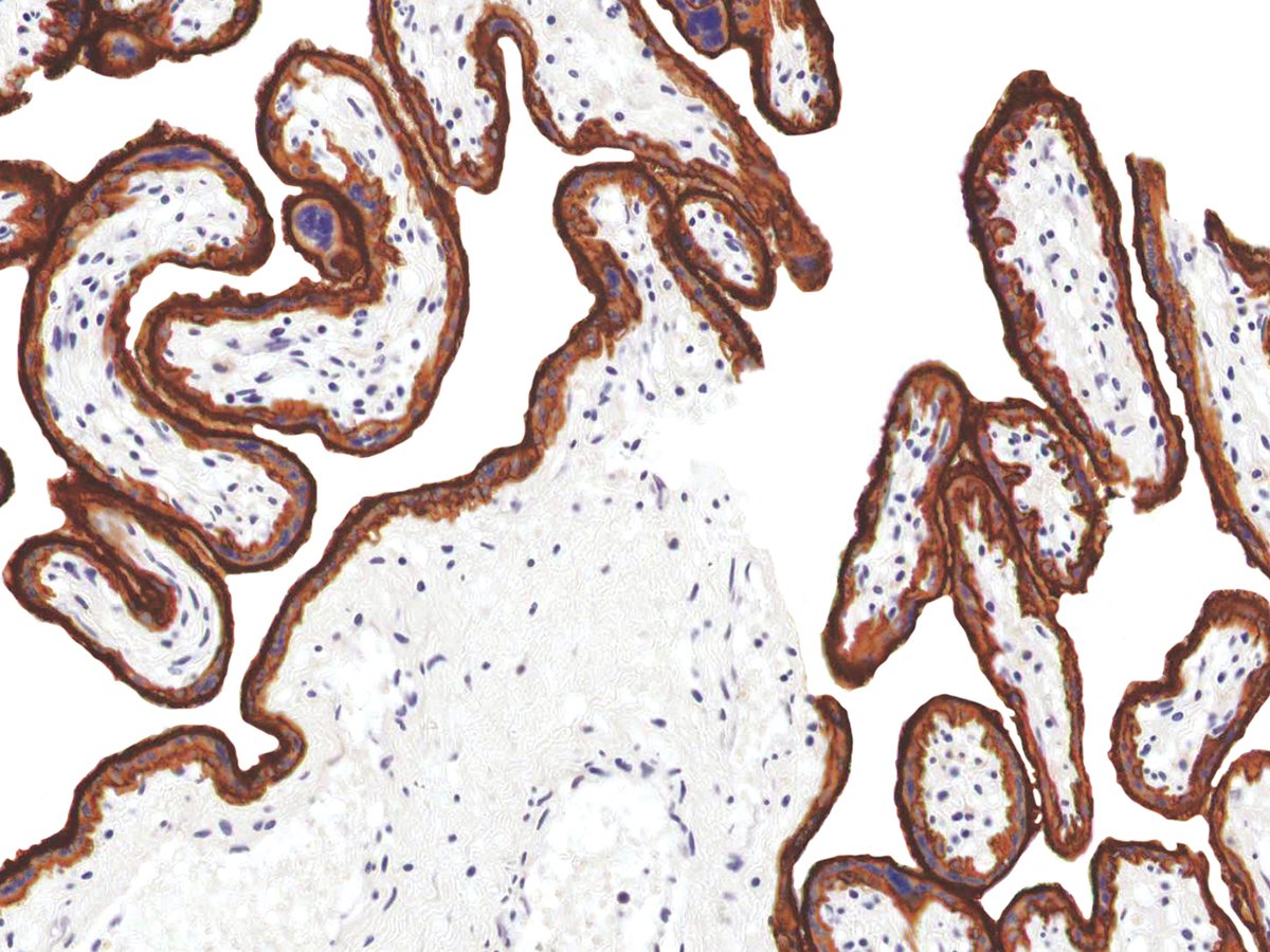 Anti-EGFR Monoclonal Antibody (Clone:IHC565)