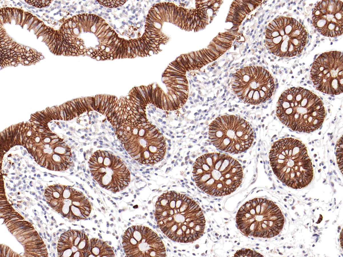 Anti-Ep-Cam Monoclonal Antibody (Clone:IHC567)