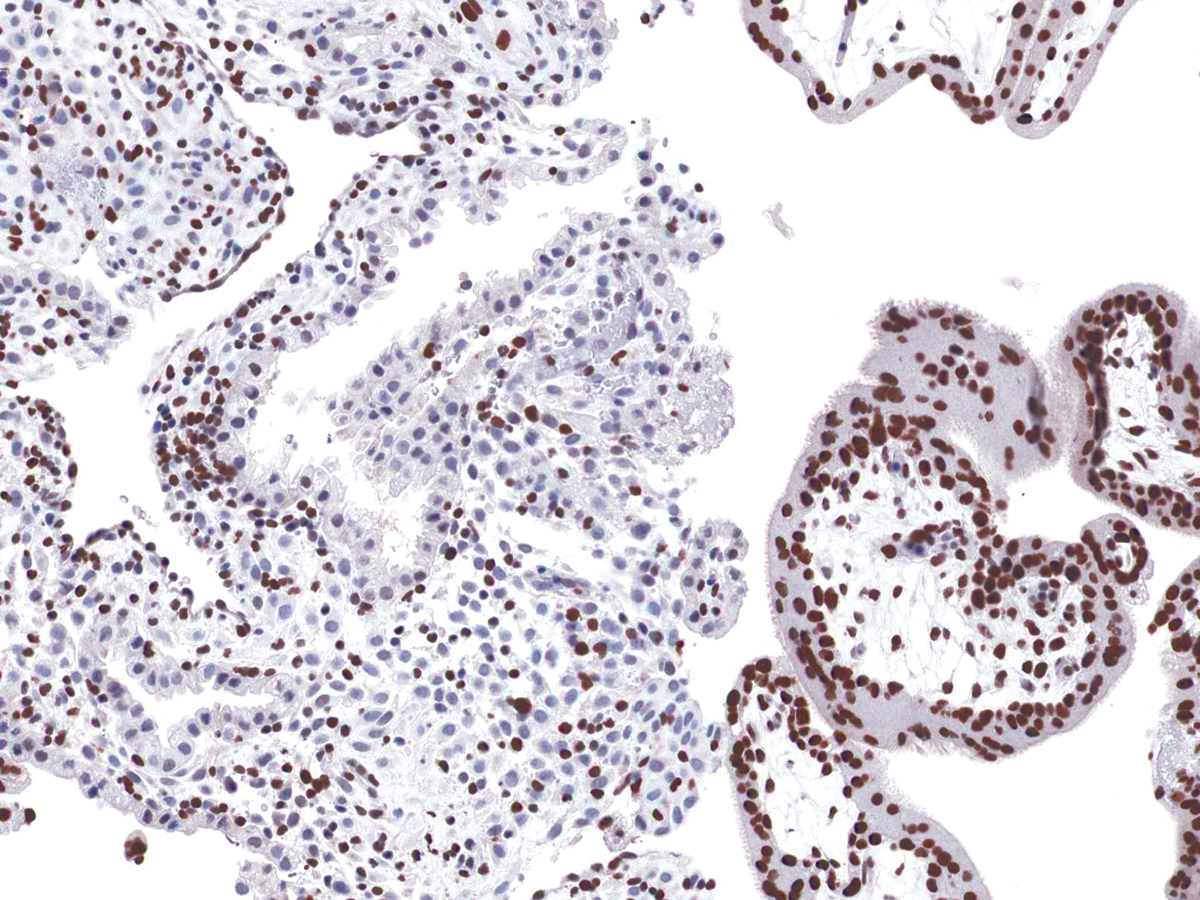 Anti-EZH2 Monoclonal Antibody (Clone:IHC570)(Discontinued)