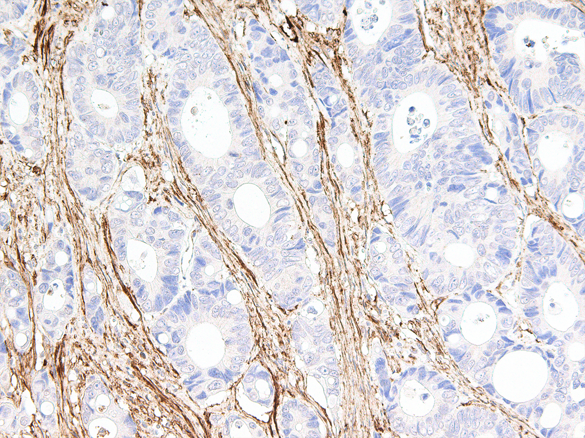 Anti-Fibronectin Monoclonal Antibody (Clone:IHC575)