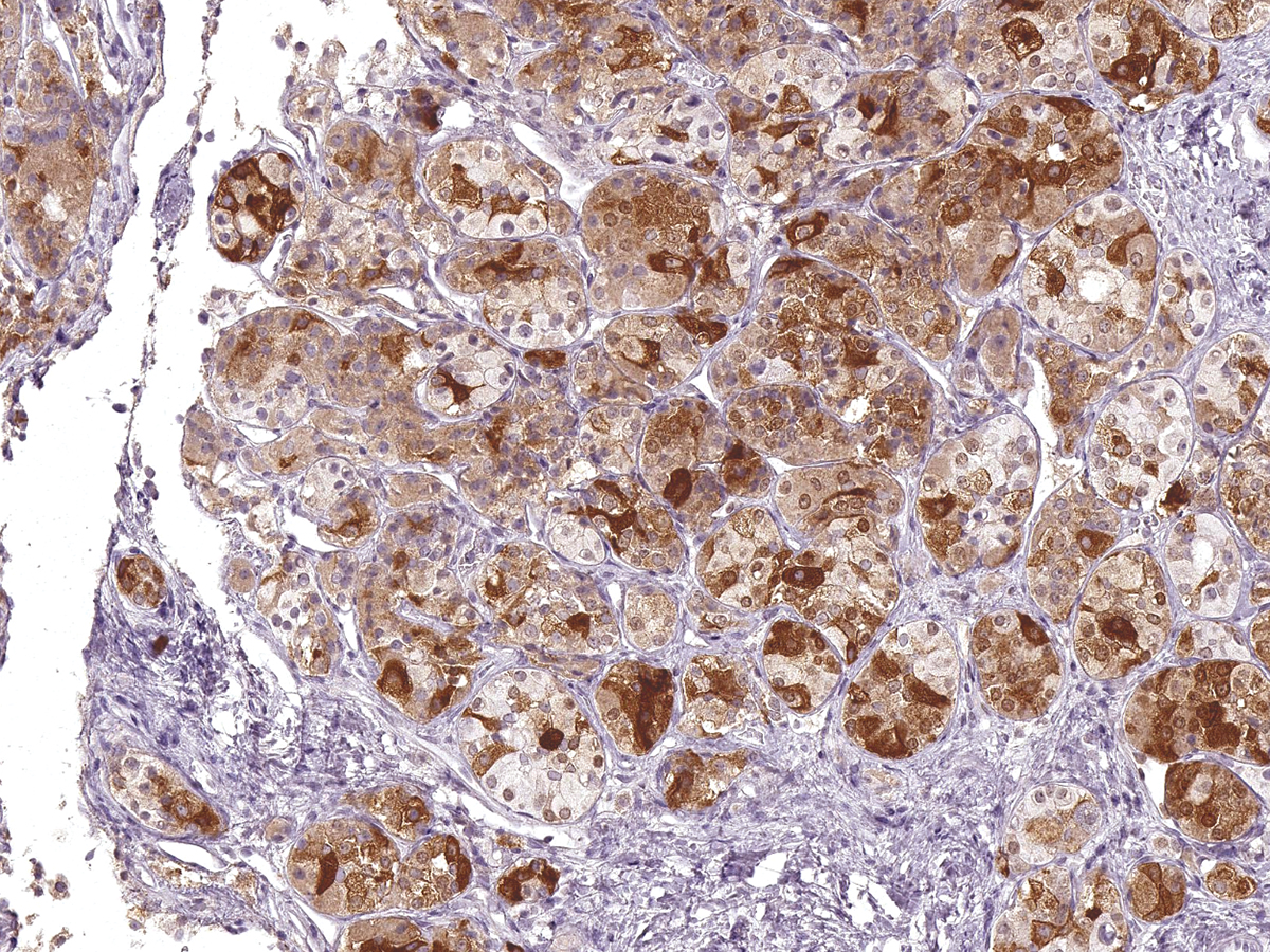 Anti-FSH Monoclonal Antibody (Clone:IHC580)