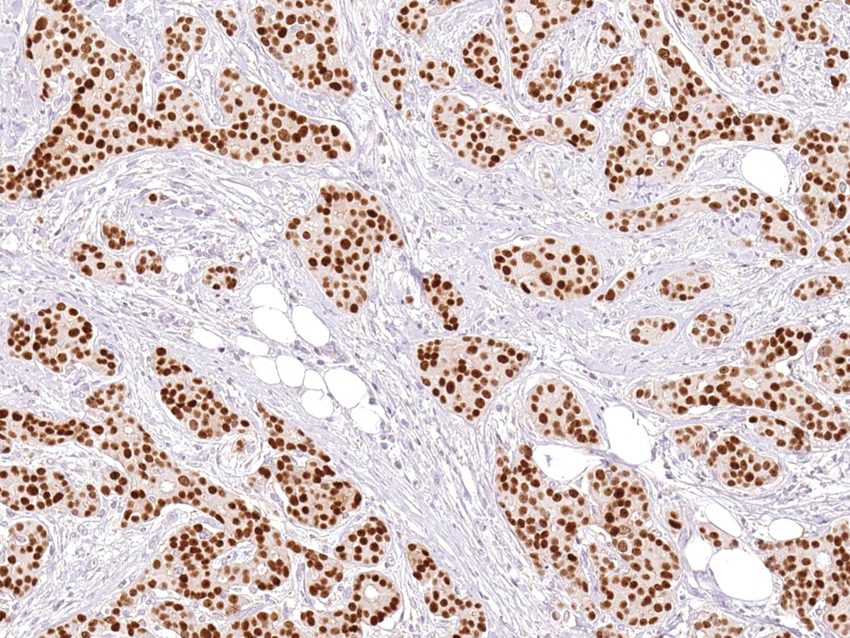 Anti-GATA3 Monoclonal Antibody (Clone:IHC583)-Ready to Use