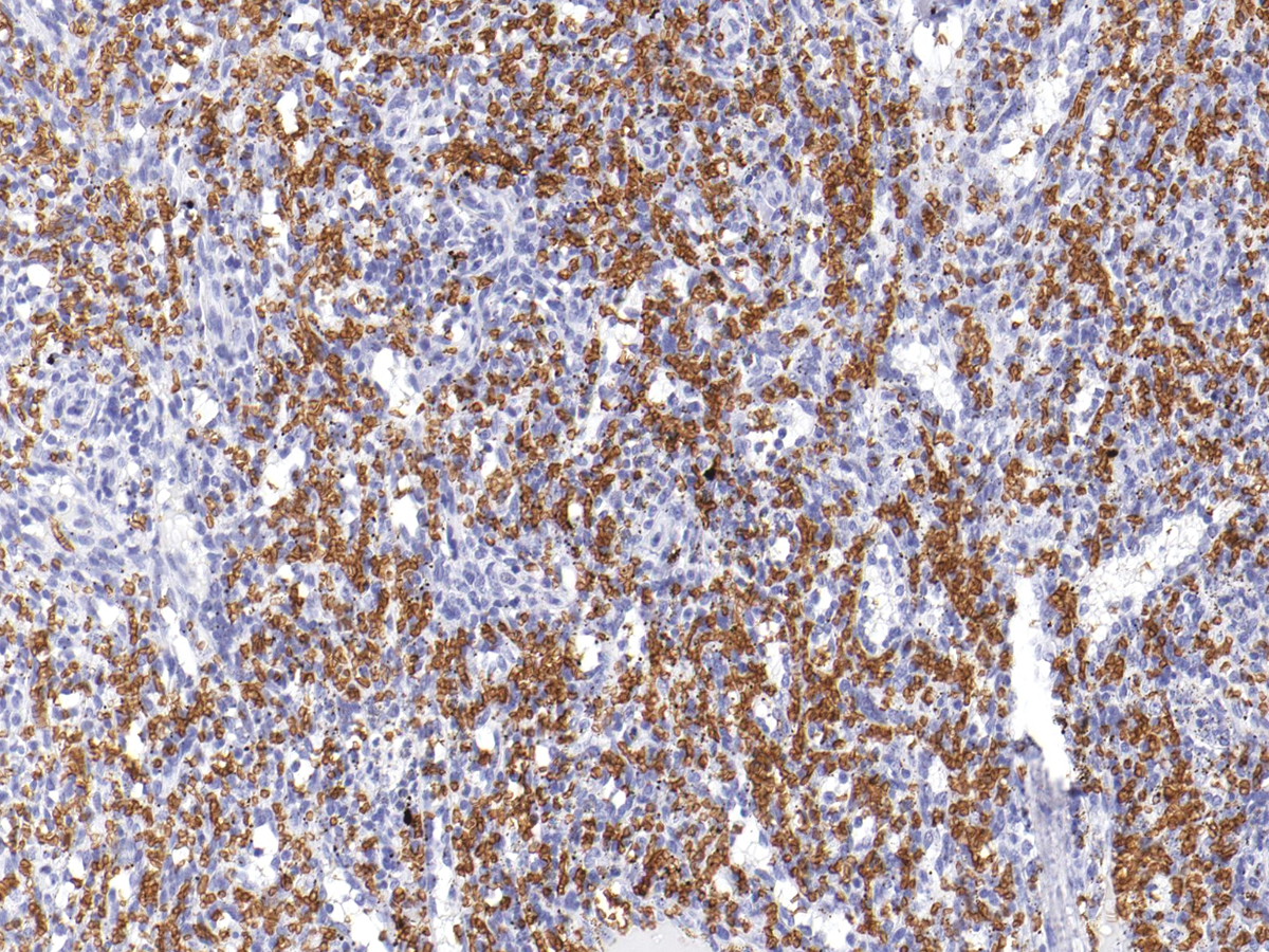 Anti-Glycophorin A Monoclonal Antibody (Clone:IHC587)