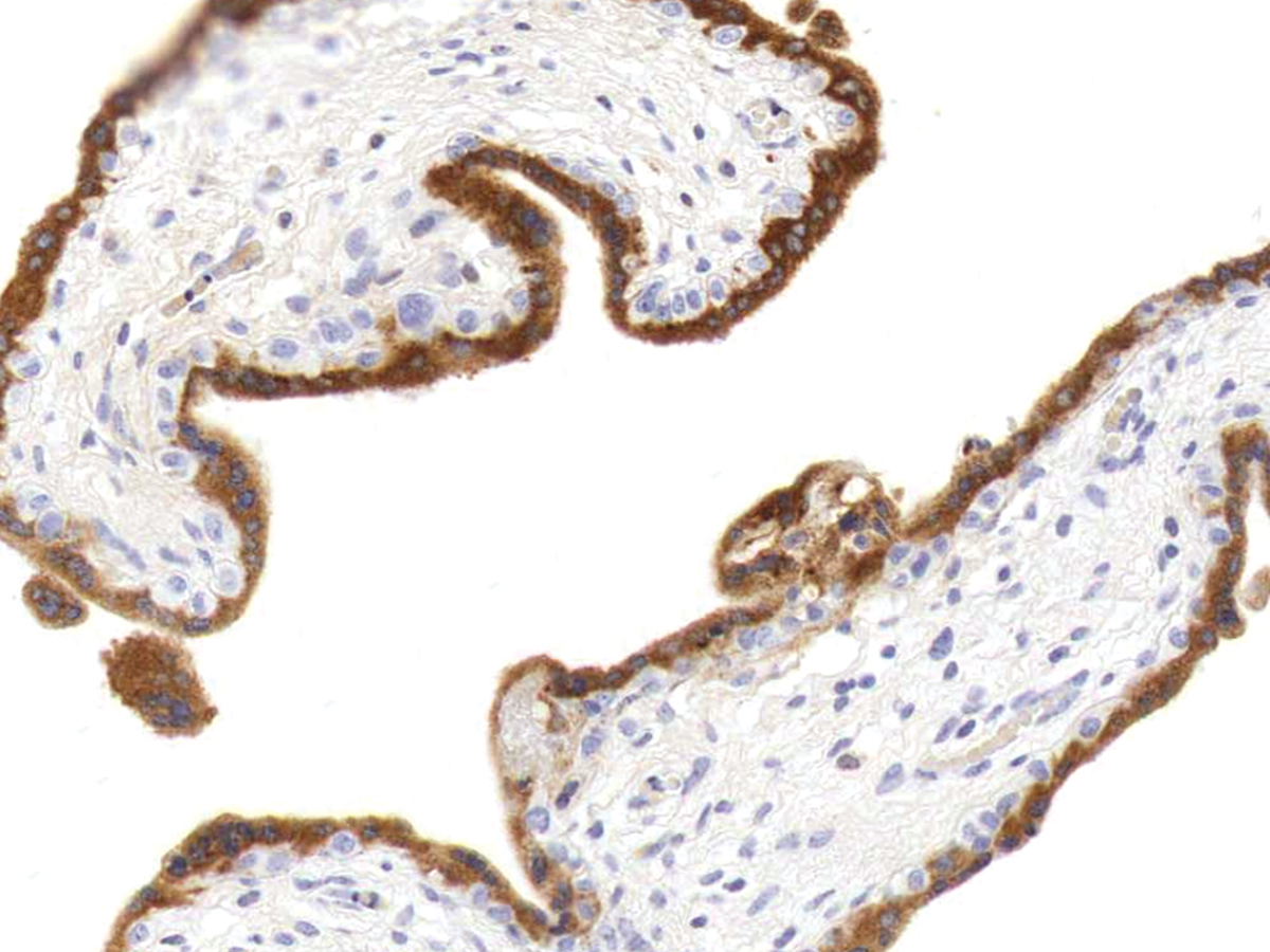 Anti-hCG Monoclonal Antibody (Clone:IHC593)