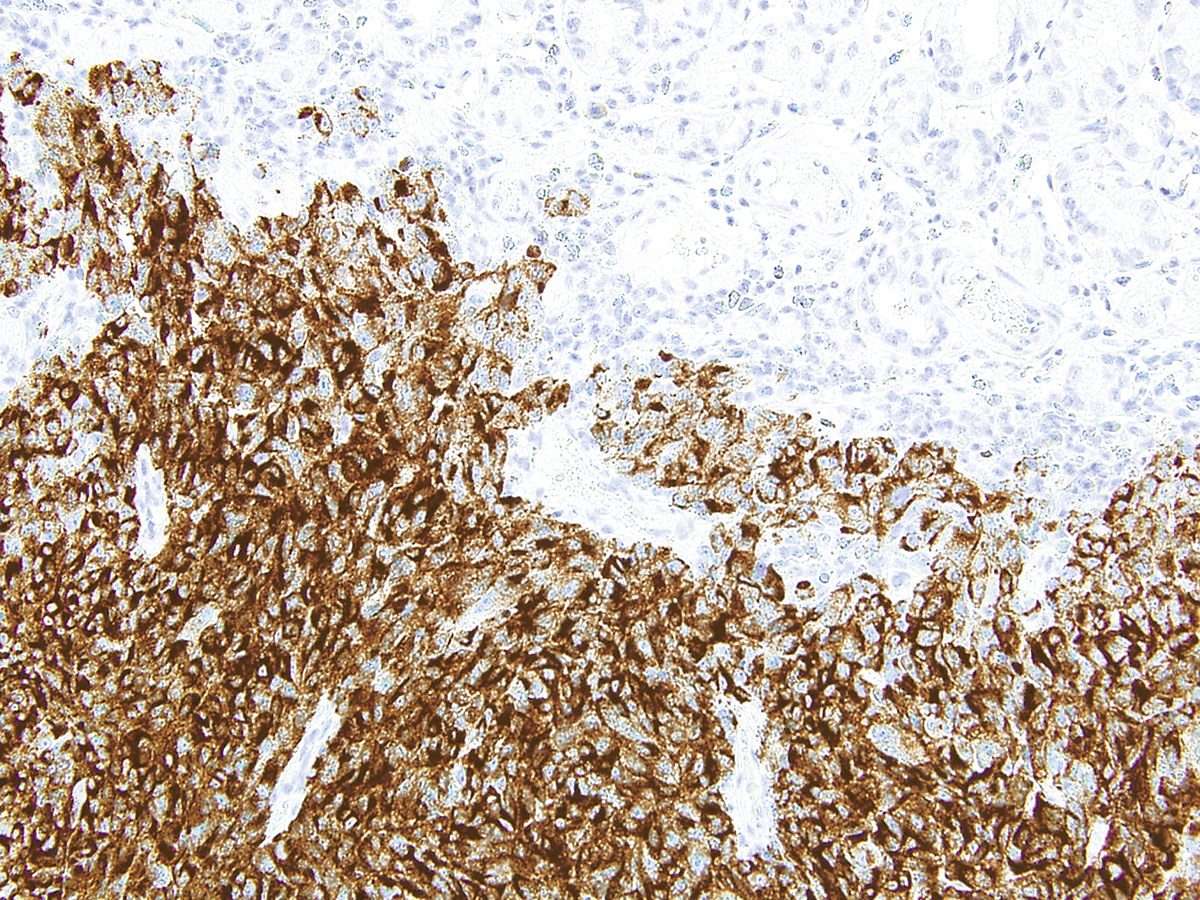 Anti-HMB-45 Monoclonal Antibody (Clone:IHC602)