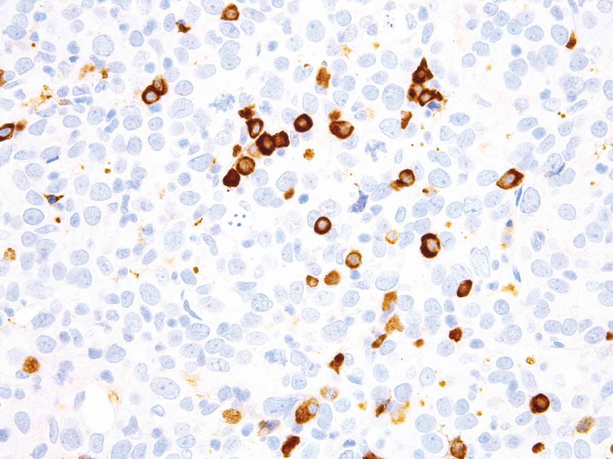 Anti-Kappa Monoclonal Antibody (Clone:IHC610)-Ready to Use