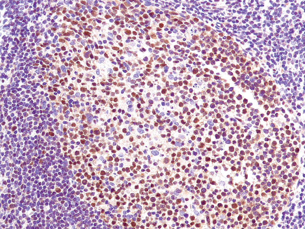 Anti-LMO2 Monoclonal Antibody (Clone:IHC615)(Discontinued)