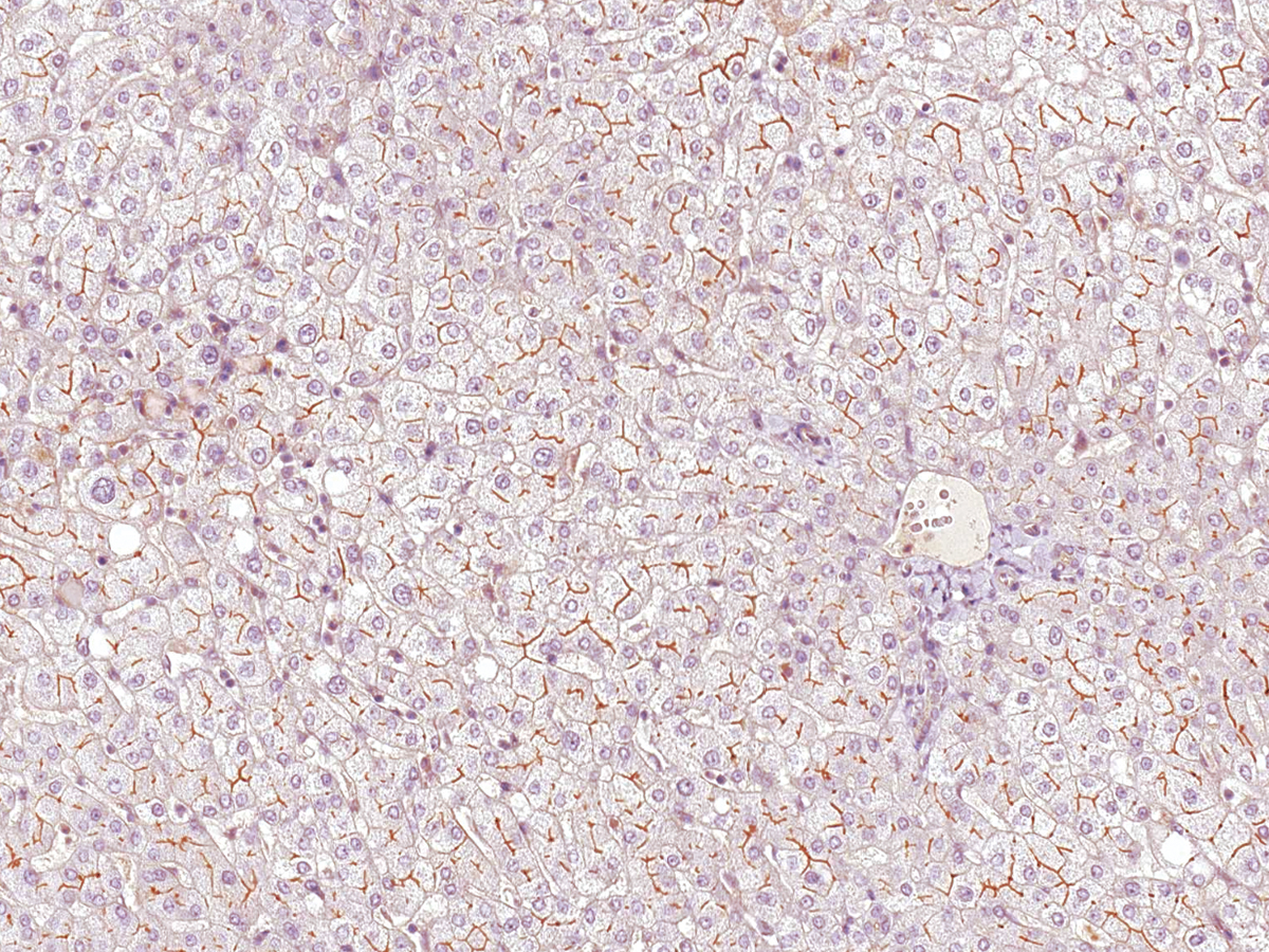 Anti-MDR3 Monoclonal Antibody (Clone:IHC621)