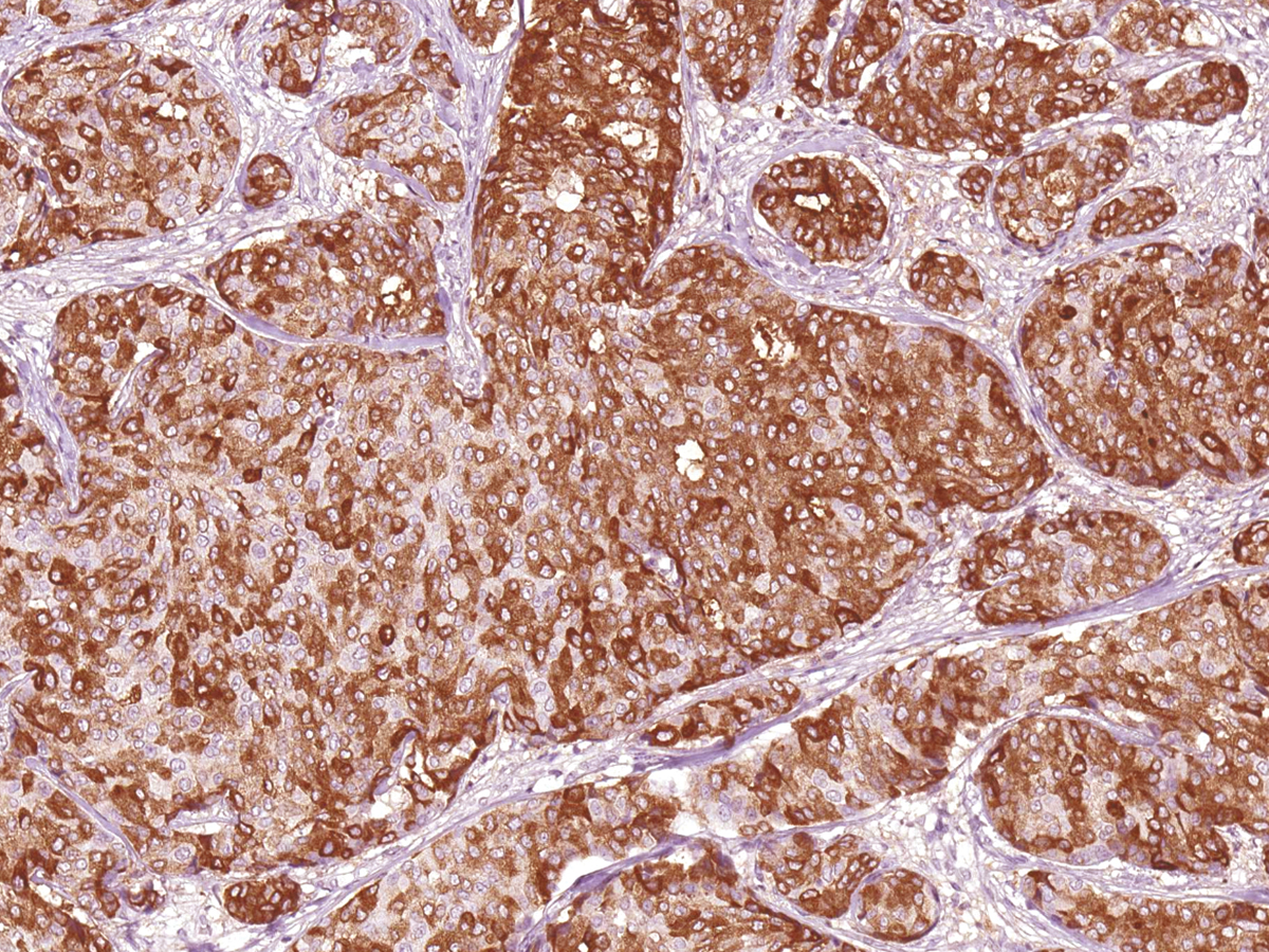 Anti-MUC1 Monoclonal Antibody (Clone:IHC623)