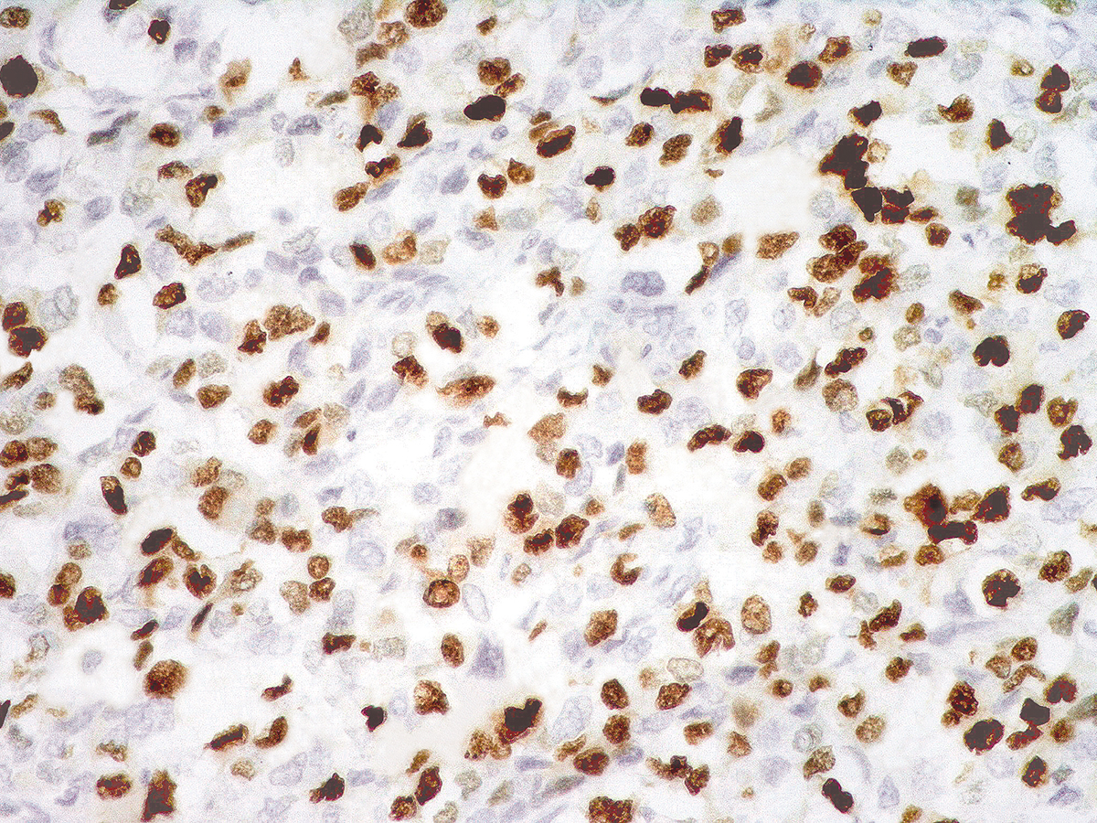 Anti-Myogenin Monoclonal Antibody (Clone:IHC631)