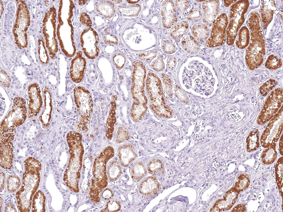 Anti-Napsin A Monoclonal Antibody (Clone:IHC635)