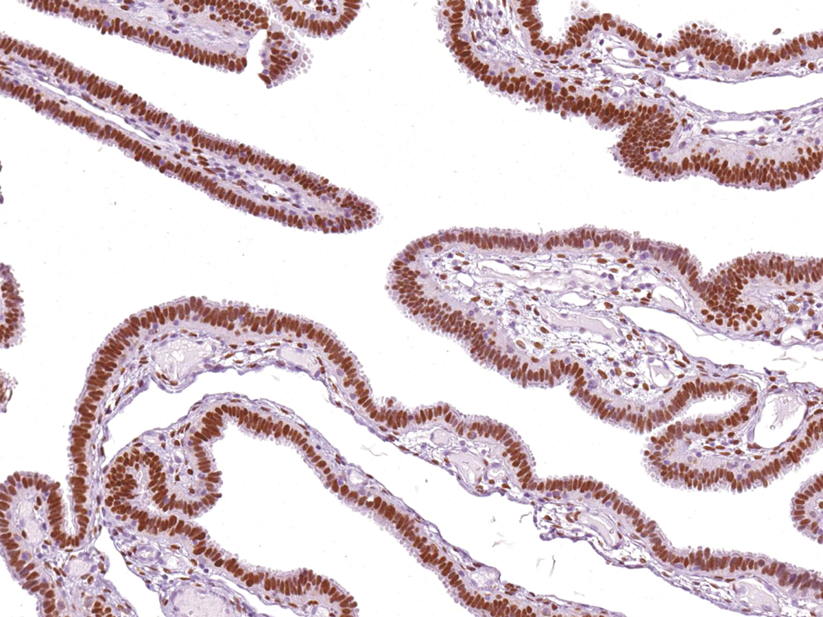 Anti-Progesterone Receptor Monoclonal Antibody (Clone:IHC651)-Ready to Use(Discontinued)