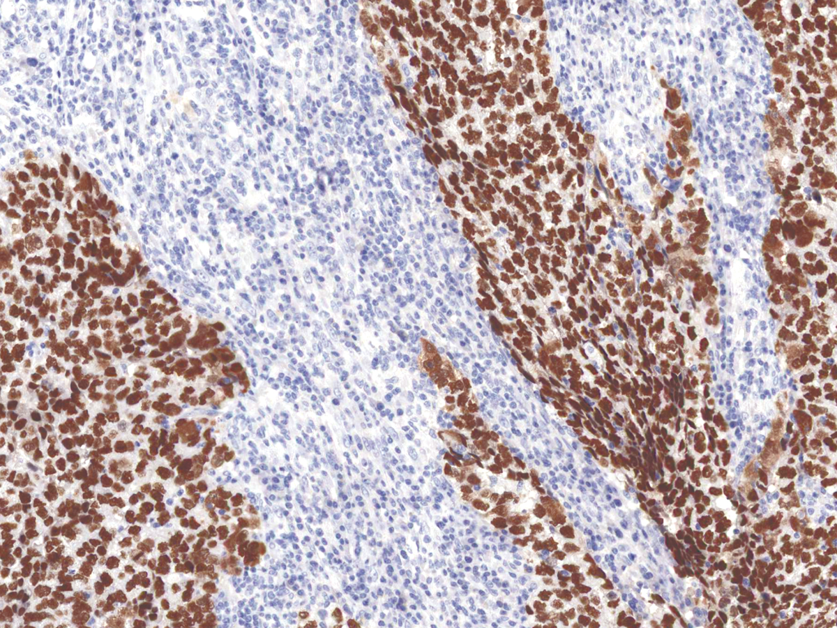 Anti-SALL4 Monoclonal Antibody (Clone:IHC659)-Ready to Use