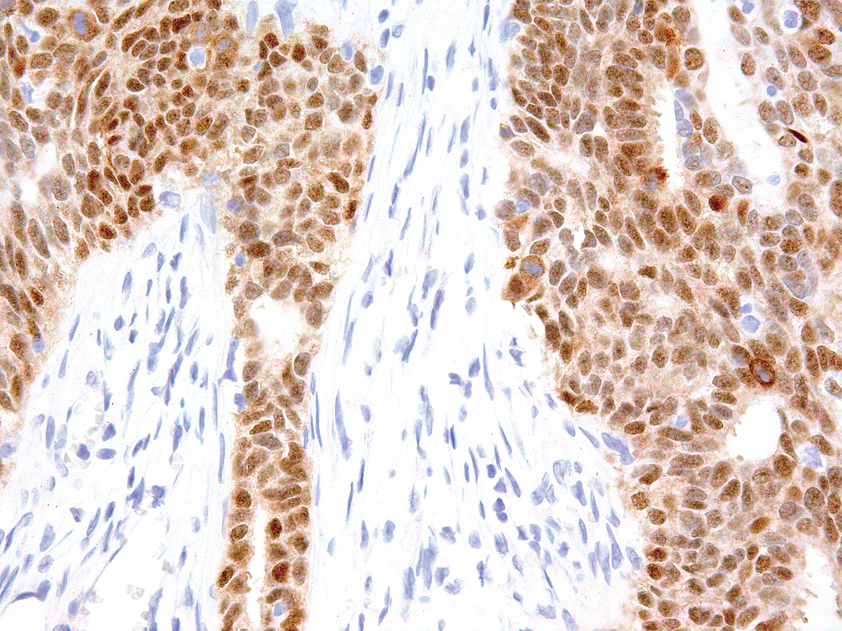 Anti-SOX-2 Monoclonal Antibody (Clone:IHC665)(Discontinued)