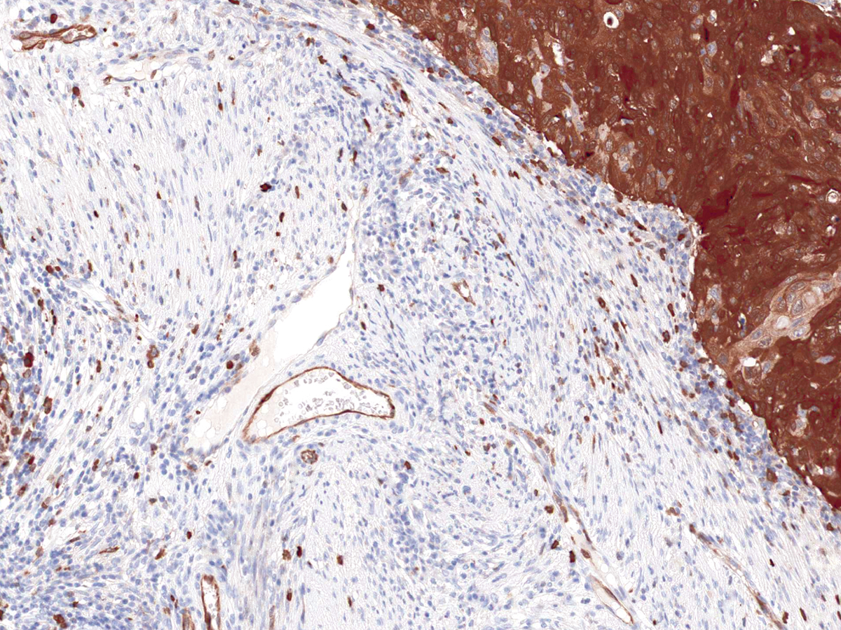 Anti-Stathmin Monoclonal Antibody (Clone:IHC667)